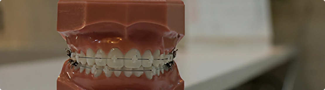 dental-insurance Banner